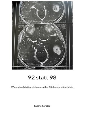 cover image of 92 statt 98